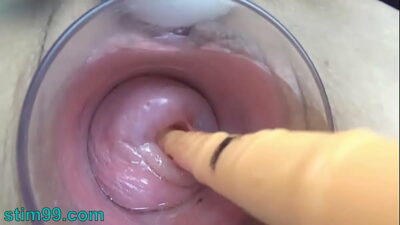 Penis extrem