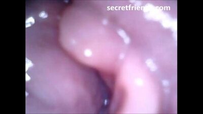 Vagina camera