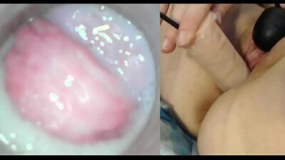 Angeschwollene Vagina